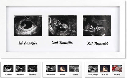 IHEIPYE Triple Sonogram Pregnancy Frame – Baby Ultrasound Picture Frame with Story for Expecting Parents, Baby Shower Frame, Baby Grow Through All Three Trimesters Frame, Nursery Decor, Black